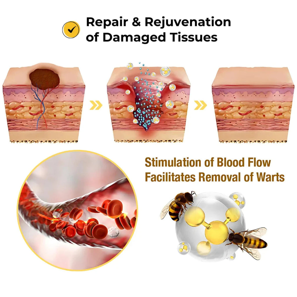 Skin Tag Remover Patch